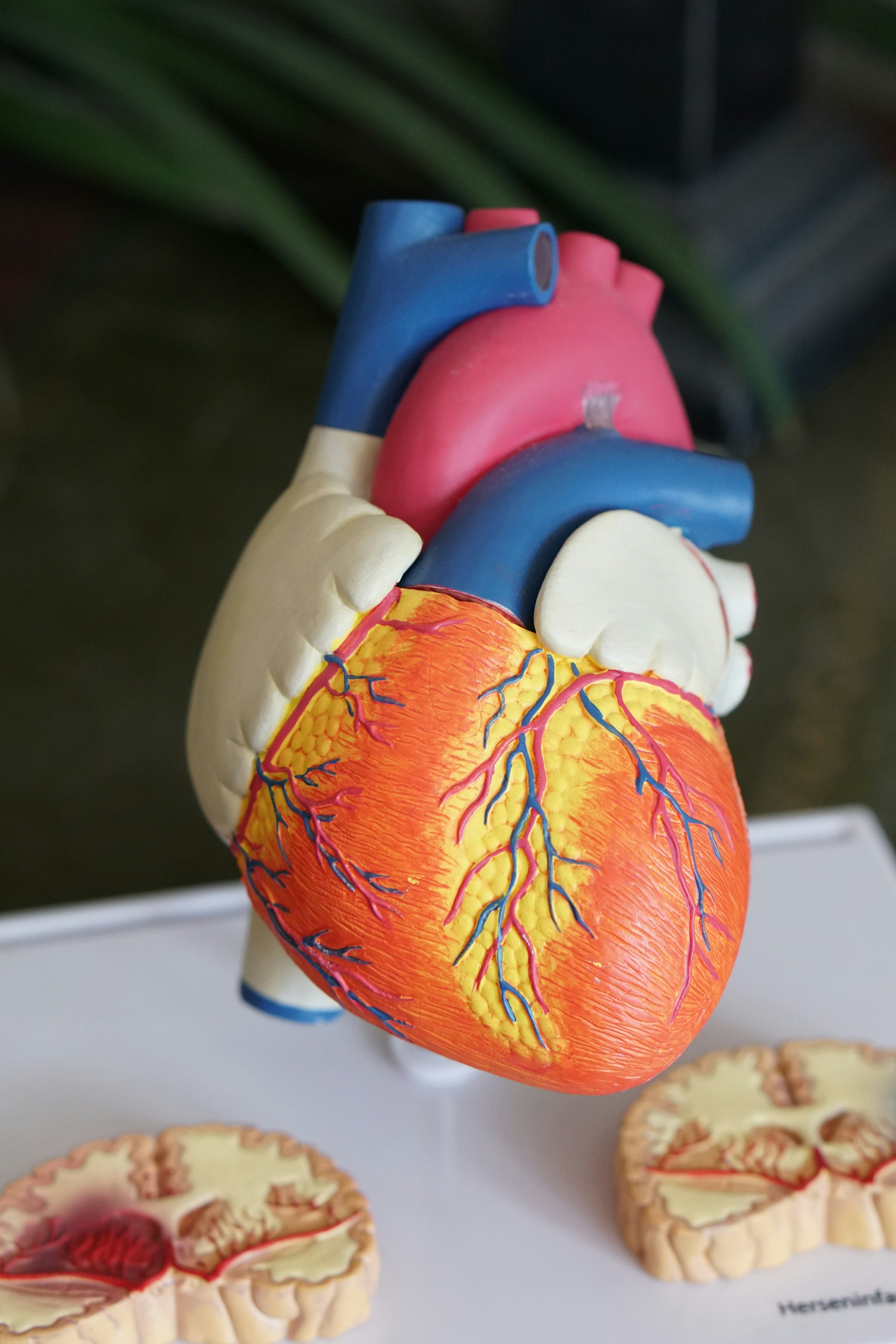 ELECTROCARDIOGRAM (ECG)
